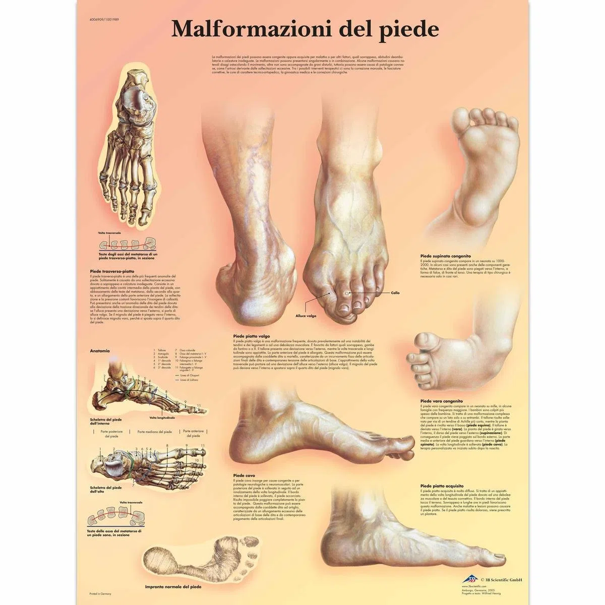 3B Scientific VR4185UU Malformazioni di Piede